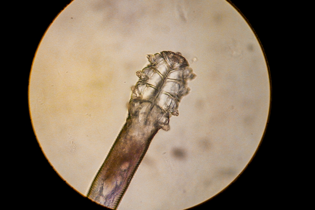 Demodex: conheça os aracnídeos que moram nos poros do seu rosto