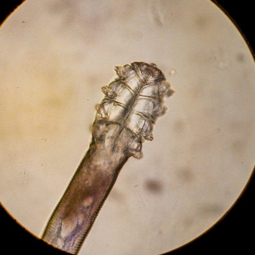 Demodex: conheça os aracnídeos que moram nos poros do seu rosto